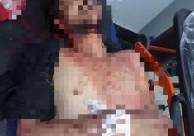 مسلح يقتل شابًا في سيارته وسط تعز