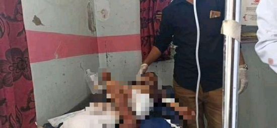 استشهاد 3 أطفال وإصابة 5 آخرين بقصف حوثي على تعز