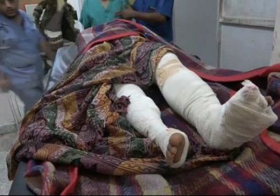 إصابة امرأة في القصف الحوثي على التحيتا 