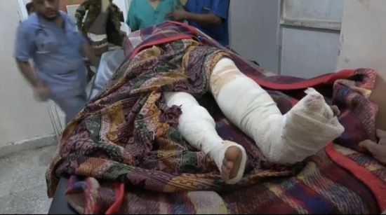 إصابة امرأة في القصف الحوثي على التحيتا 