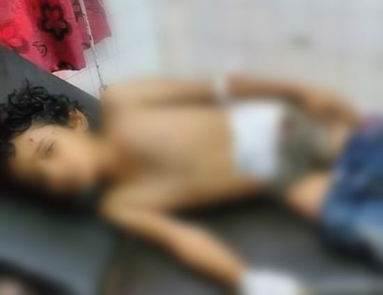 إسعاف طفل جريح بشظايا قذيفة حوثية في تعز