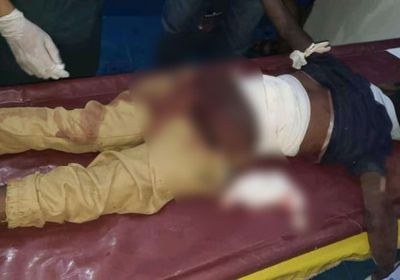 قناص حوثي يجرح طفلًا بعيار ناري غرب تعز