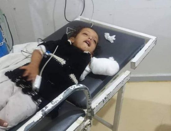 أسد يقضم ذراع طفلة بحديقة الحيوان في إب