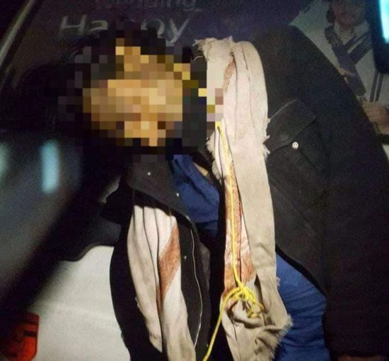 انتحار شاب شنقا في إب