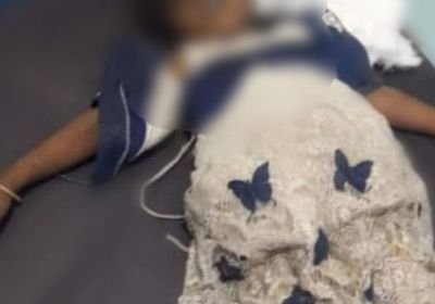 استشهاد وإصابة طفلة وامرأتين بقصف حوثي على مقبنة