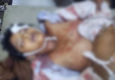 حوثي يقتل طفلًا برصاصة في الرأس شمال تعز