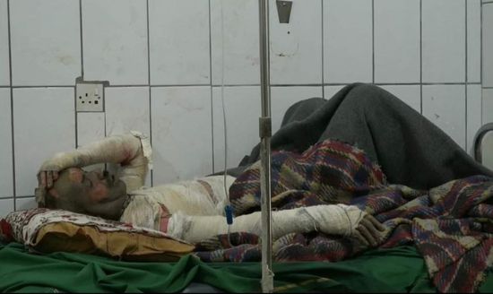 توفي إثر إصابته.. سعيد يلحق بزوجته بعد حرق الحوثي منزلهما بتعز