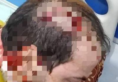 رفض دفع إتاوة الحوثي.. اعتداء وحشي على تاجر بصنعاء