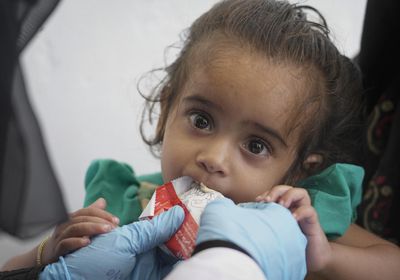 يونيسف: دعم كندي لعلاج 75 ألف طفل من الهزال