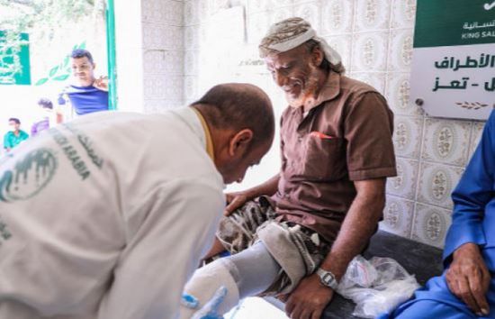 498 مستفيدا من خدمات "الأطراف الصناعية" في تعز