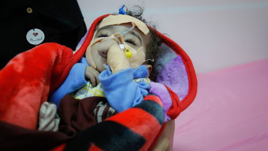 يونيسف: 11.3 مليون طفل يحتاجون لمساعدات منقذة للحياة