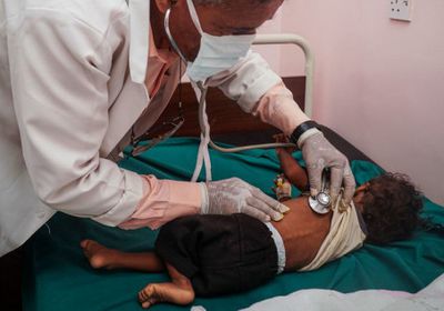 غريسلي: تدهور معدلات الأمن الغذائي في اليمن