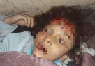 يقتل طفلته ويهرب في إب