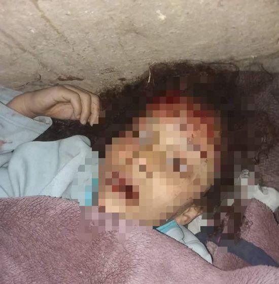 يقتل طفلته ويهرب في إب