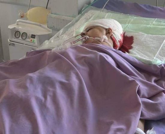 قناص حوثي يطلق النار على امرأة في تعز