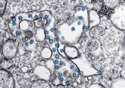 شفاء 8 مصابين من فيروس كورونا بمحافظتين