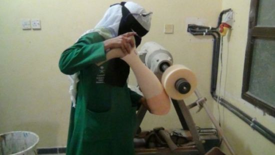 الأطراف الصناعية بعدن يستقبل 381 مستفيدا بشهر