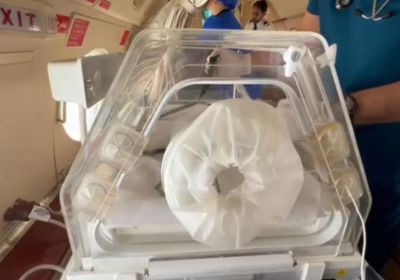 سلمان للإغاثة يتأهب لنقل التوأم مودة ورحمة للرياض