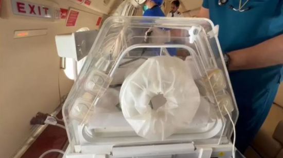 سلمان للإغاثة يتأهب لنقل التوأم مودة ورحمة للرياض