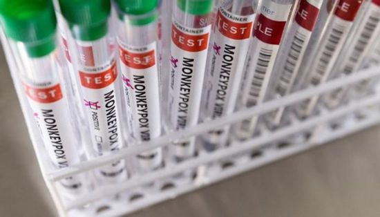 سلوفينيا تسجل أول إصابة بجدري القرود