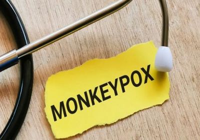 الجزائر تعلن جاهزيتها للتصدي لجدري القرود