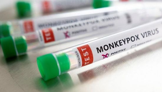اليونان تعلن تسجيل أول إصابة بجدري القرود