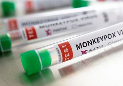 اكتشاف أول حالة إصابة بجدري القرود في تركيا