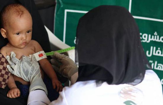147 ألف مستفيدا من مشروع التغذية للأطفال والأمهات الحوامل