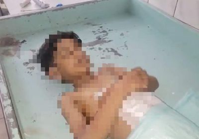 وفاة البراء.. استشهاد طفل من جرحى القصف الحوثي على الروضة