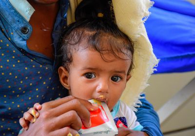 يونيسف تقدم أدوية وعلاجات لمرضى سوء التغذية في حجة