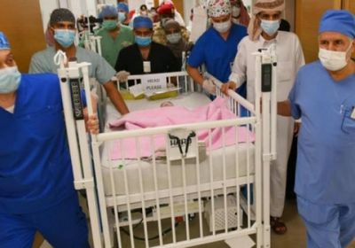 بدء عملية فصل التوأم السيامي "مودة ورحمة" بالرياض