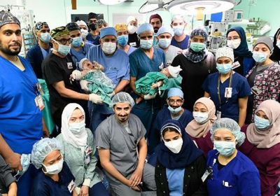 نجاح فصل التوأم السيامي مودة ورحمة