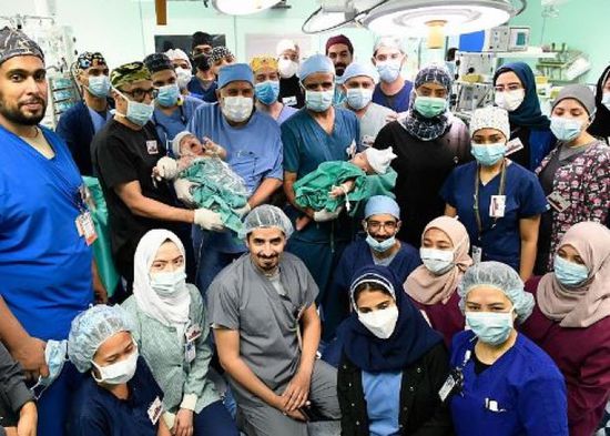 نجاح فصل التوأم السيامي مودة ورحمة