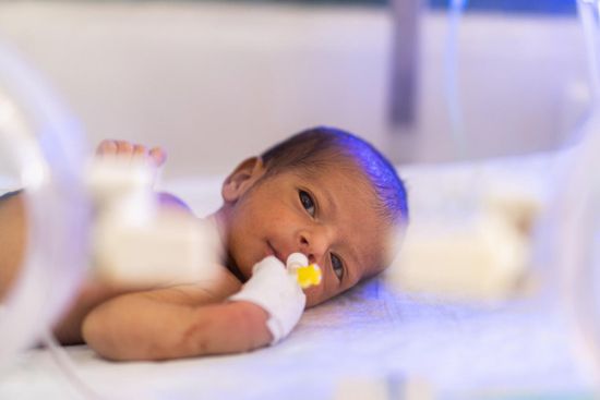 يونيسف: الرضاعة الطبيعية منقذة لحياة الأطفال في اليمن