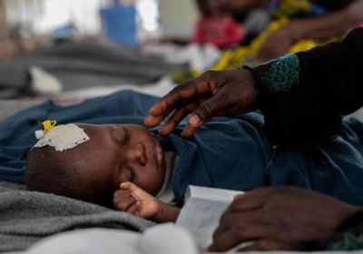 في أسبوعين.. الحصبة تقتل 157 طفلا في زيمبابوي &nbsp;