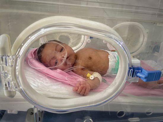 الصحة العالمية: دعم 25% من خدمات رعاية حديثي الولادة في اليمن