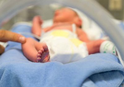 دراسة تكشف مخاطر الولادة القيصرية على الأطفال
