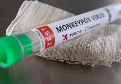 تسجيل أول إصابة بفيروس جدري القرود بأوكرانيا
