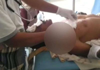 جرح مزارع جراء انفجار لغم في حراثته بحيس