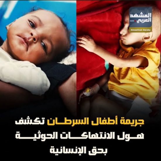 جريمة ‫أطفال السرطان‬ تكشف هول ‫الانتهاكات الحوثية‬ بحق الإنسانية (فيديوجراف)‫