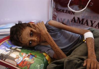تحليل: صورة مرعبة للأمن الغذائي وقادة كل همهم اقناعنا بـ "واحدية الثورة اليمنية"