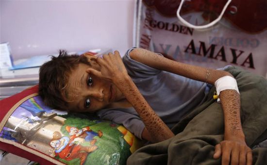 تحليل: صورة مرعبة للأمن الغذائي وقادة كل همهم اقناعنا بـ "واحدية الثورة اليمنية"