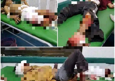 إصابة 3 أطفال بجروح خطيرة في قصف حوثي غرب تعز