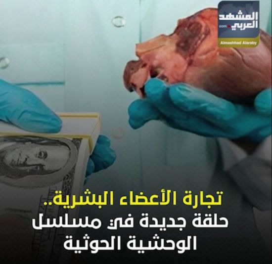 تجارة الأعضاء البشرية.. حلقة جديدة في مسلسل الوحشية ‫الحوثية‬ (فيديوجراف)