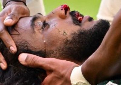 تعرف على طبيعة إصابة اللاعب ياسر الشهراني