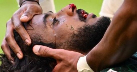 تعرف على طبيعة إصابة اللاعب ياسر الشهراني