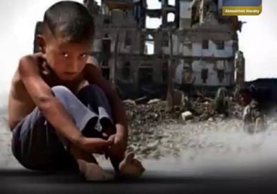 أطفال ⁧‫اليمن‬⁩.. مأساة تتفاقم (فيديوجراف)‫