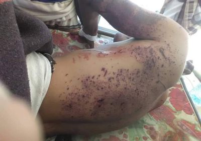 شهيد وجريحان في تفجيرين استهدفا القوات الجنوبية بمودية