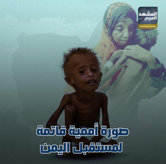 صورة أممية قاتمة لمستقبل اليمن (فيديوجراف)