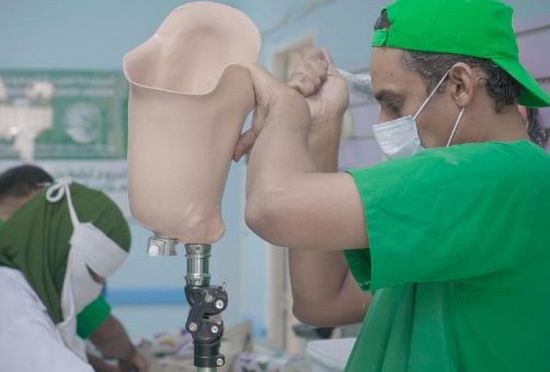 مركز الأطراف الصناعية بسيئون يستقبل 328 مستفيدا